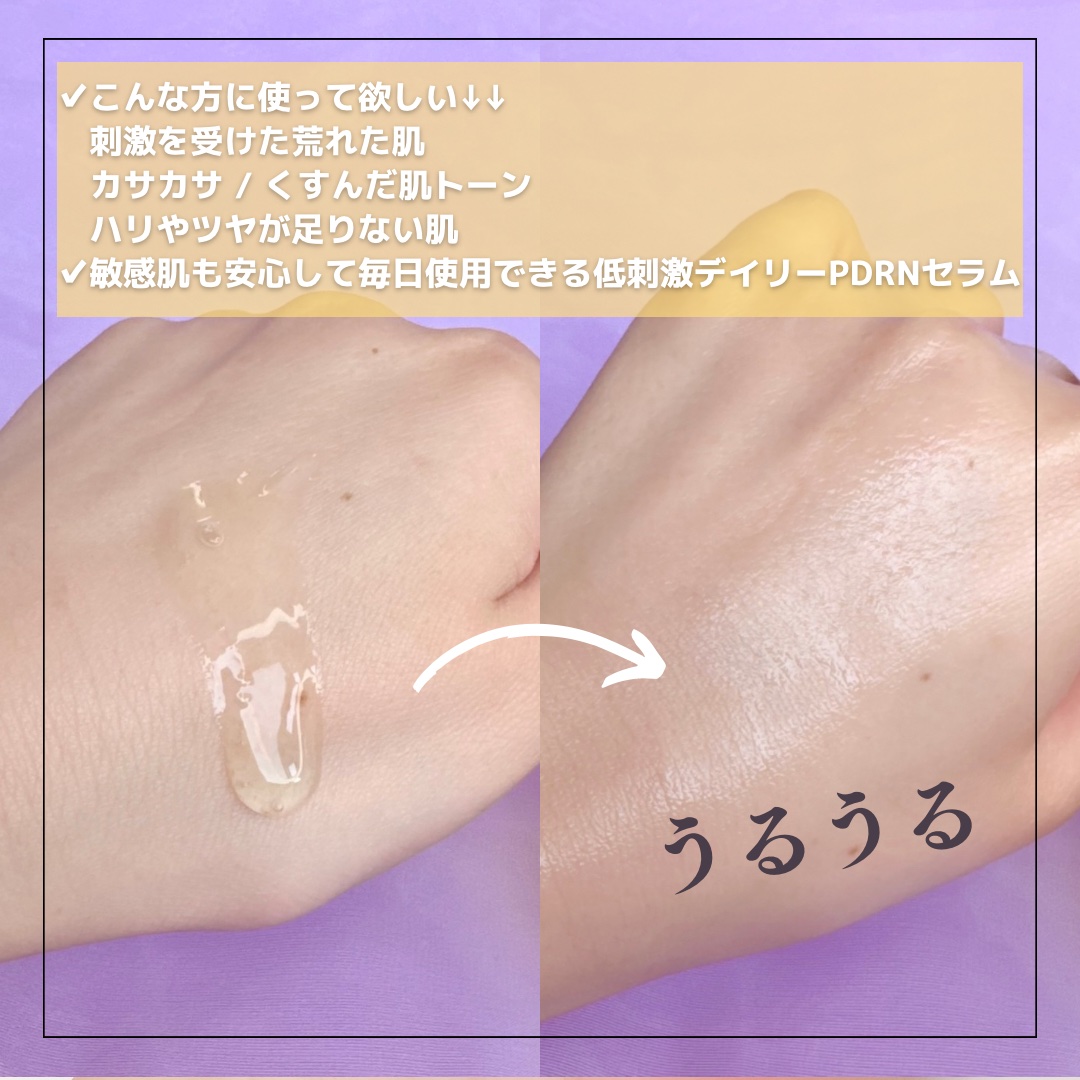 ビタペアCPDRN水潤セラム/ネイチャーリパブリック/美容液を使ったクチコミ（3枚目）