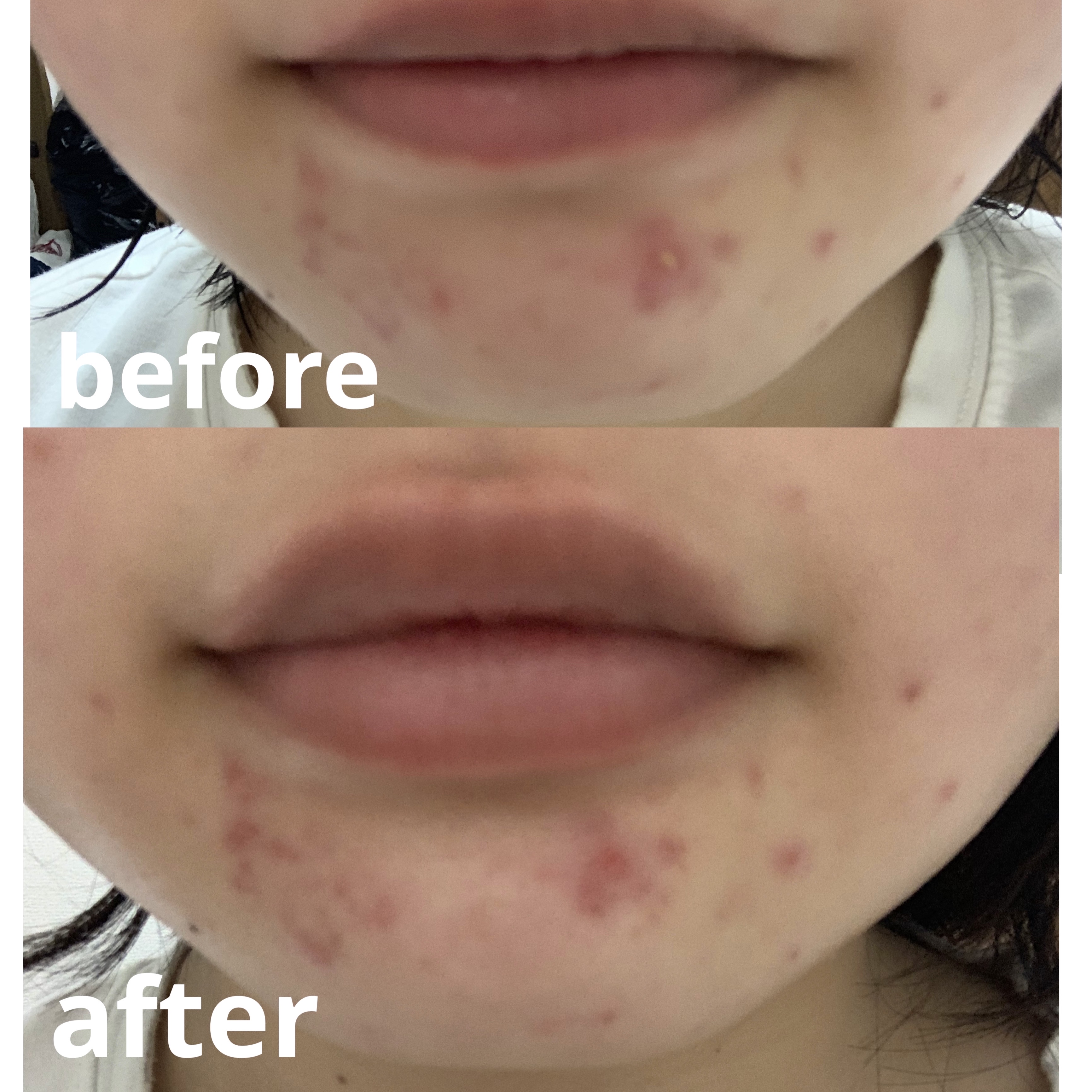 を使ったクチコミ（2枚目）