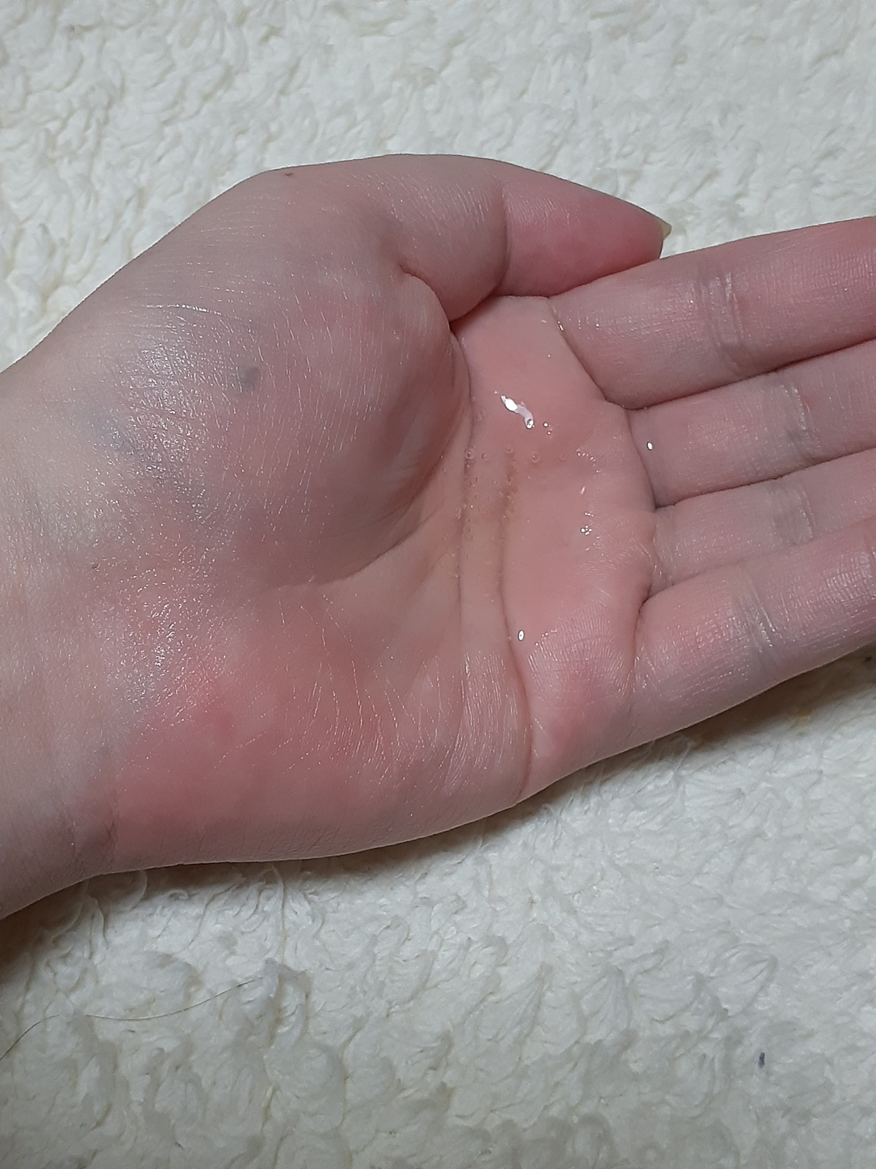 ビタ-グルタチオンスリーエックス トナー/TRTR/化粧水を使ったクチコミ（2枚目）