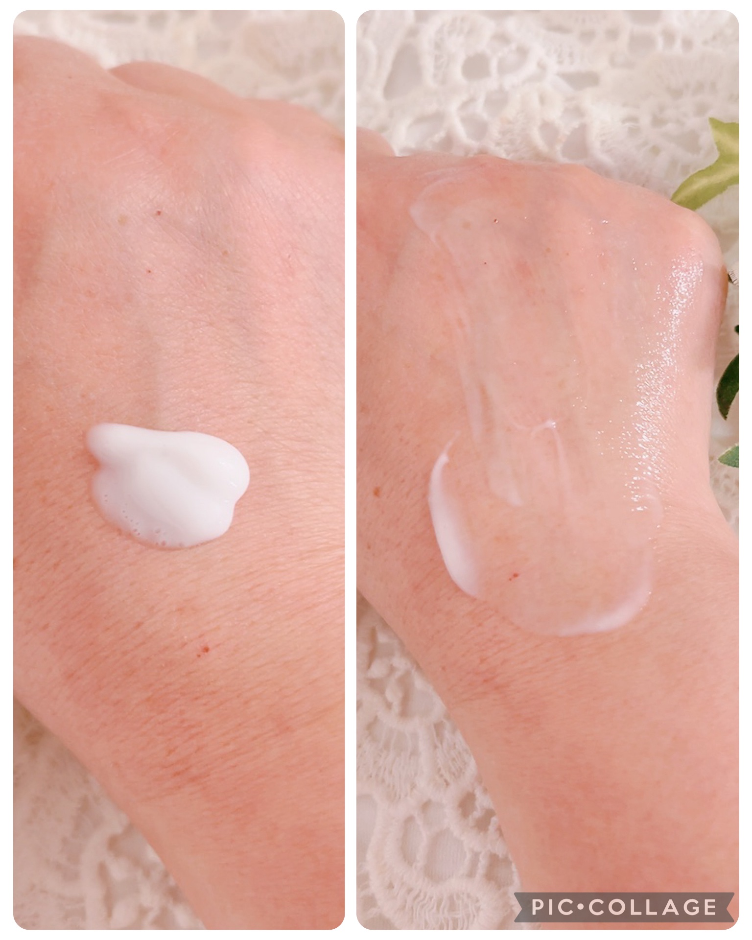 ミノン アミノモイスト 薬用アクネケア ミルク 100ｇ/ミノン/乳液を使ったクチコミ（3枚目）