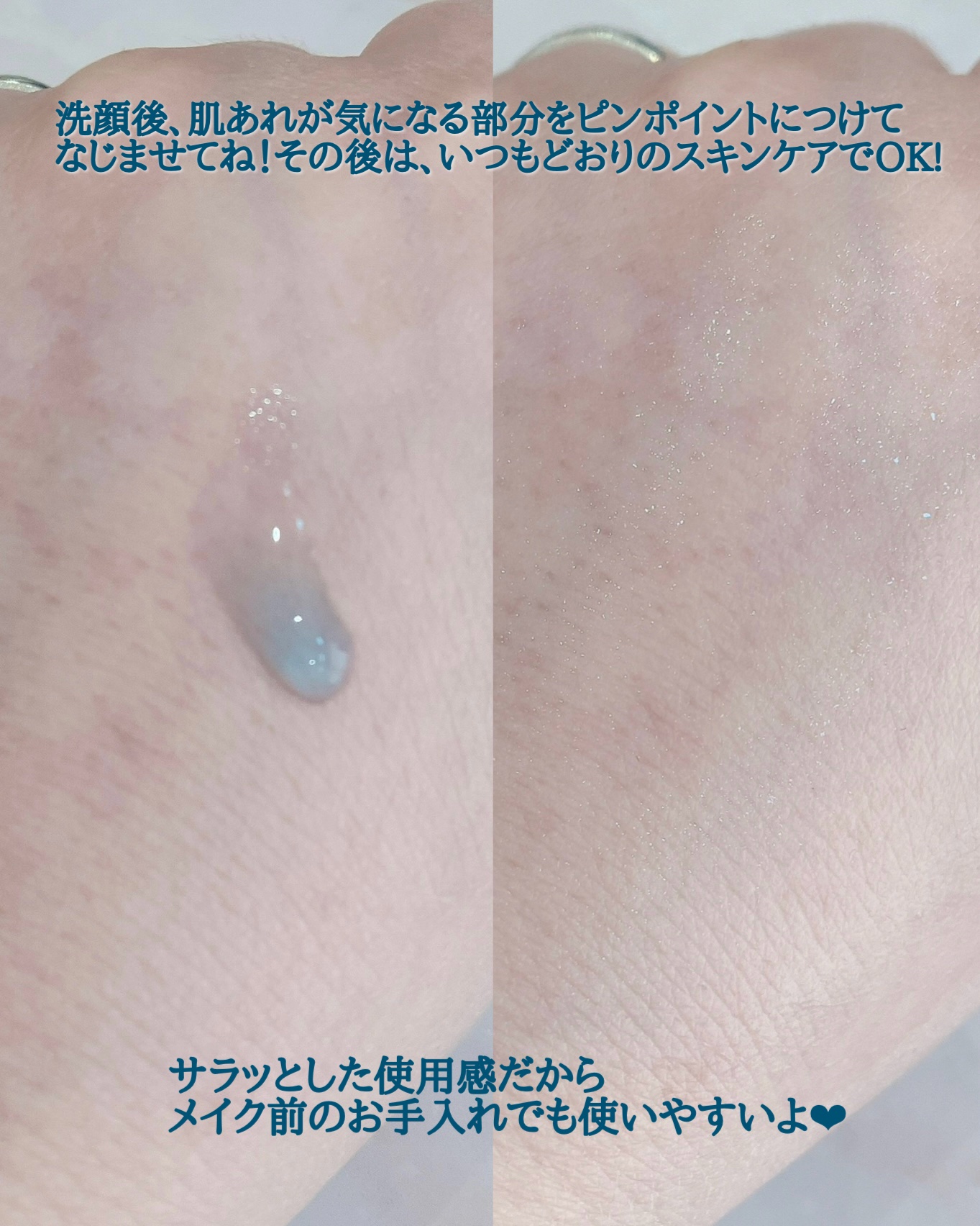 ミッドナイトブルーユースアクティベーティングドロップ(20ml)/Klairs/美容液を使ったクチコミ（3枚目）