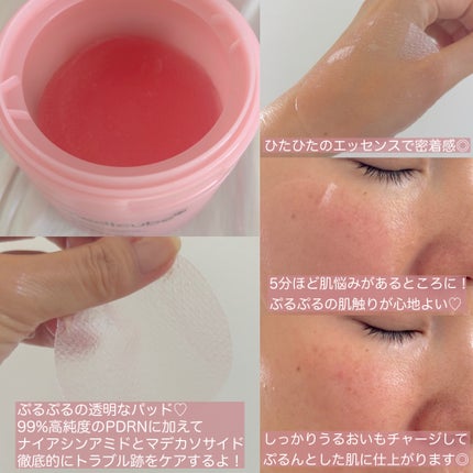 PDRNコラーゲントーニングゲルトナーパット/MEDICUBE/トナーパッドを使ったクチコミ(3枚目)