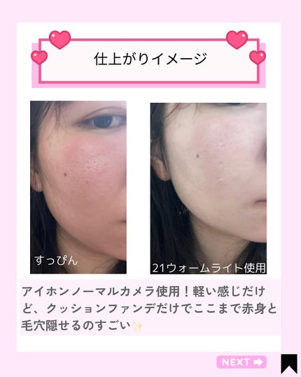 Kana on LIPS 「\全部かわいすぎて選べない🥹💭/【ABOUTTONE】のスキン..」(8枚目)