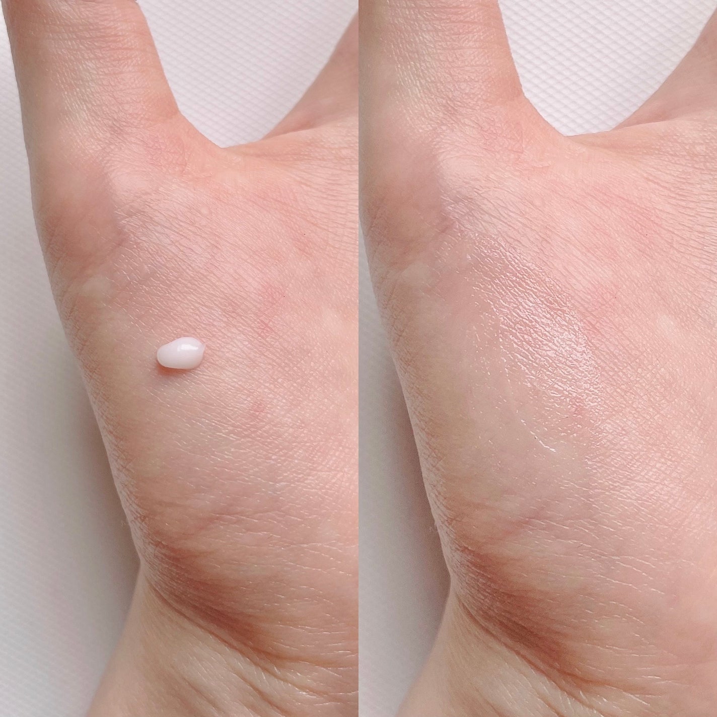 ガーリック リードルショット スポットクリーム/VT/フェイスクリームを使ったクチコミ(4枚目)