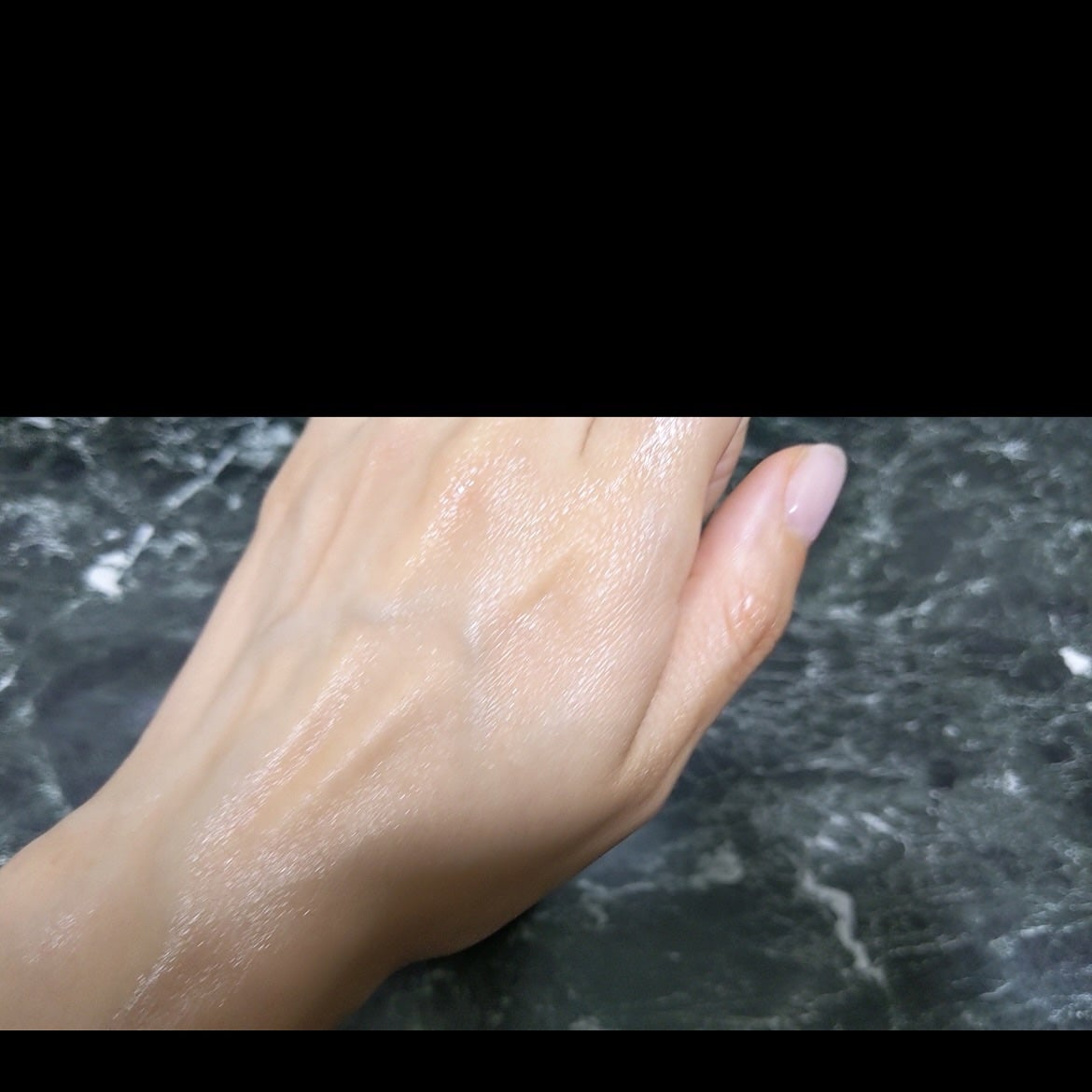 リマージ糸リフティングアンプル/REVENIP/美容液を使ったクチコミ(4枚目)