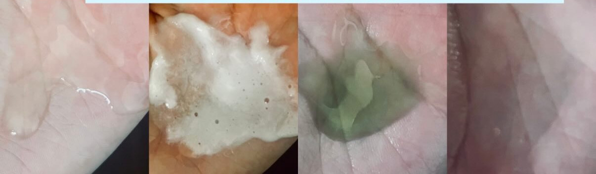 スカルプダム リフレッシュ シャンプー&トリートメント/Dr.Twenty Project/市販シャンプーを使ったクチコミ（2枚目）