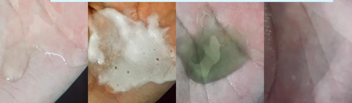 スカルプダム リフレッシュ シャンプー&トリートメント/Dr.Twenty Project/市販シャンプーを使ったクチコミ(2枚目)