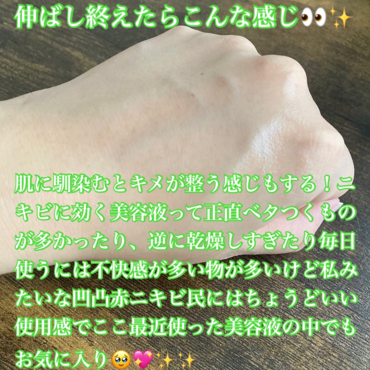 ノスカナイン トラブル セラム/FATION/美容液を使ったクチコミ(6枚目)