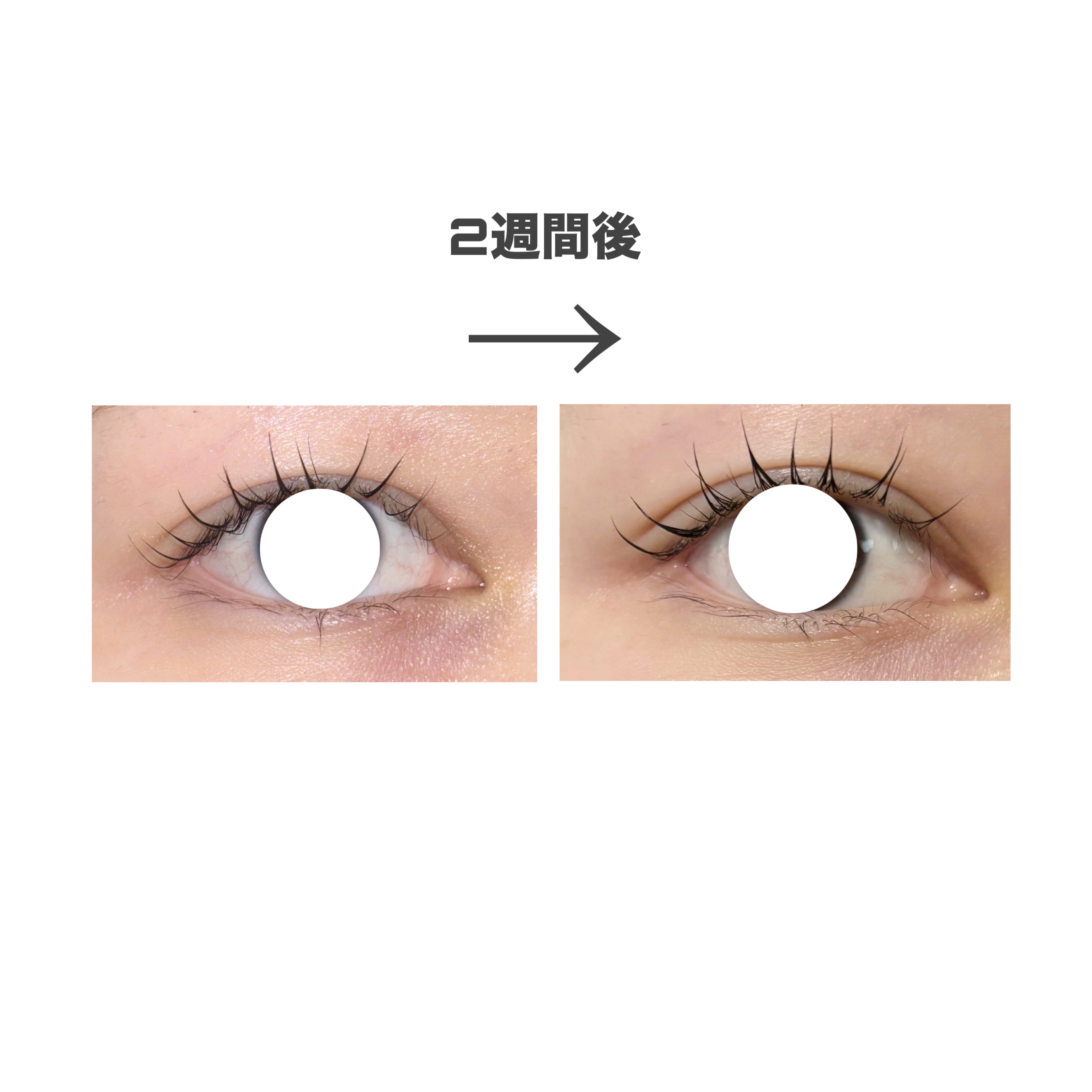 アイラッシュエッセンシャルセラム/epais/まつげ美容液を使ったクチコミ（2枚目）