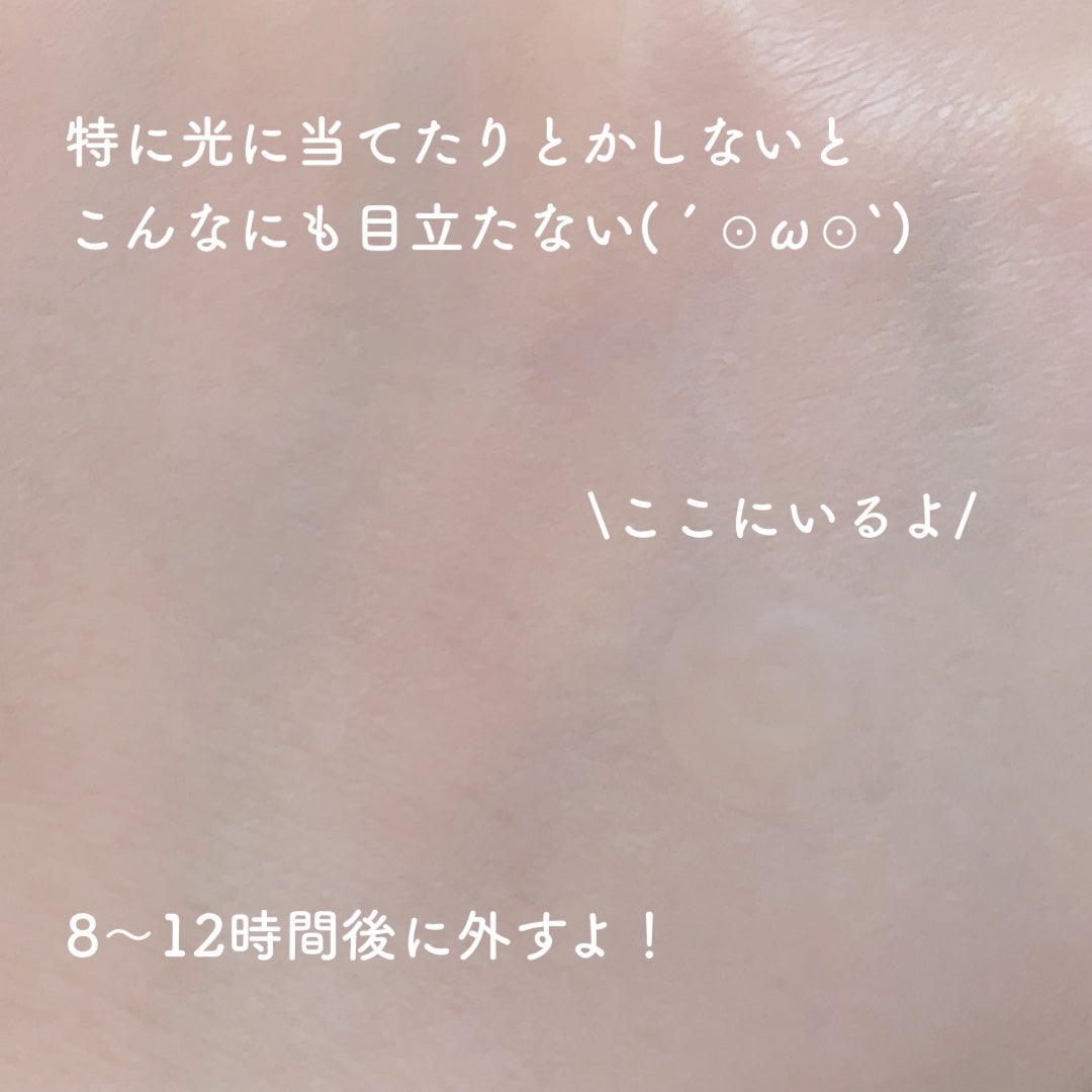 ガーリック リードルショット スポットクリーム/VT/フェイスクリームを使ったクチコミ(5枚目)