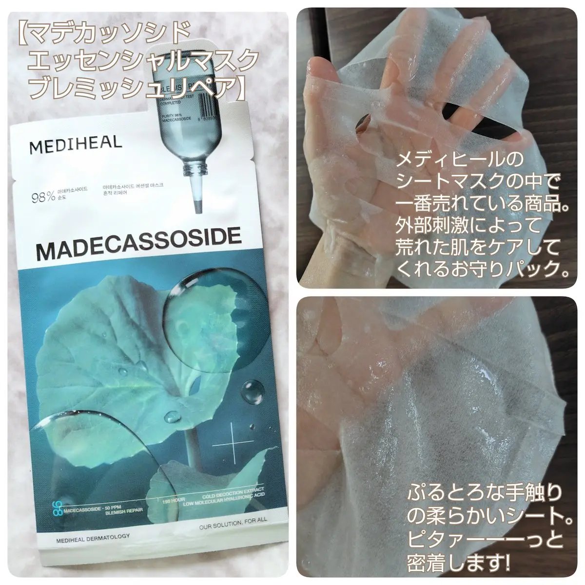 マデカッソシド エッセンシャルマスク/MEDIHEAL/シートマスク・パックを使ったクチコミ（2枚目）