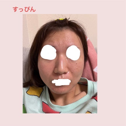 ラクトフィット ゴールド/ラクトフィット/健康サプリメントを使ったクチコミ(5枚目)