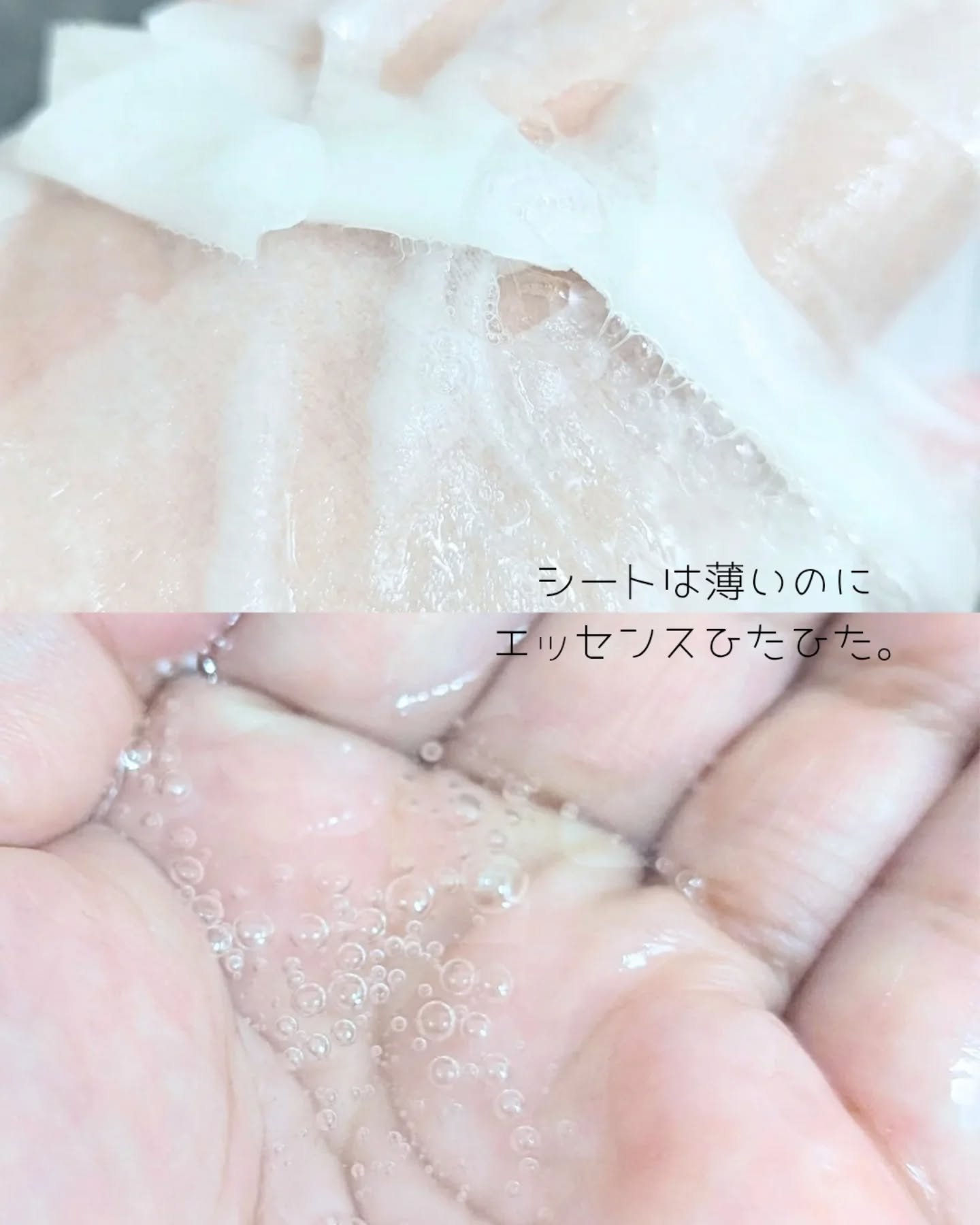 マデカッソシド エッセンシャルマスク/MEDIHEAL/シートマスク・パックを使ったクチコミ（2枚目）