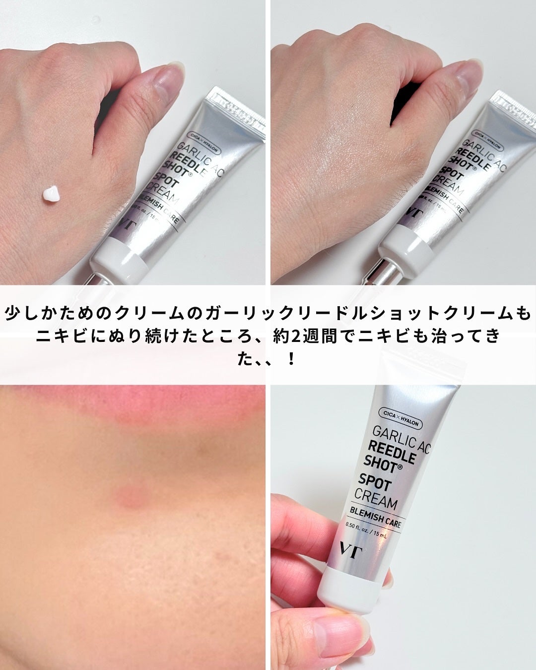 ガーリック リードルショット スポットクリーム/VT/フェイスクリームを使ったクチコミ(4枚目)