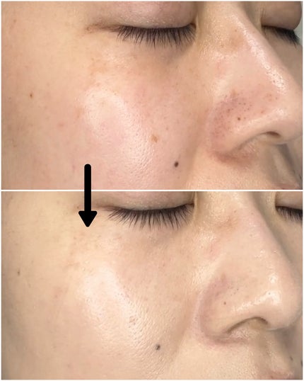 ヴェルヴェットラスティングパクト/AGE20’s/その他ファンデーションを使ったクチコミ(9枚目)