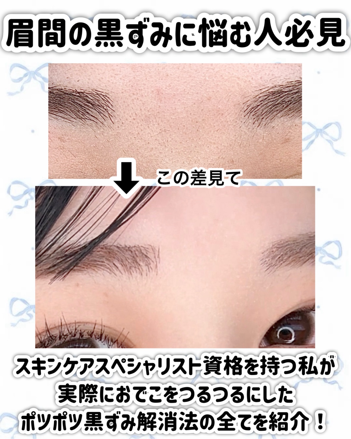 アンドハニー クレンジングバーム クリア/&honey/クレンジングバームを使ったクチコミ（2枚目）