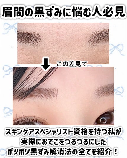 泥ジェル洗顔/ファンケル/その他洗顔料を使ったクチコミ(2枚目)