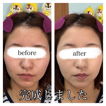 トーンパーフェクティング パレット/DECORTÉ/パレットコンシーラーを使ったクチコミ(10枚目)