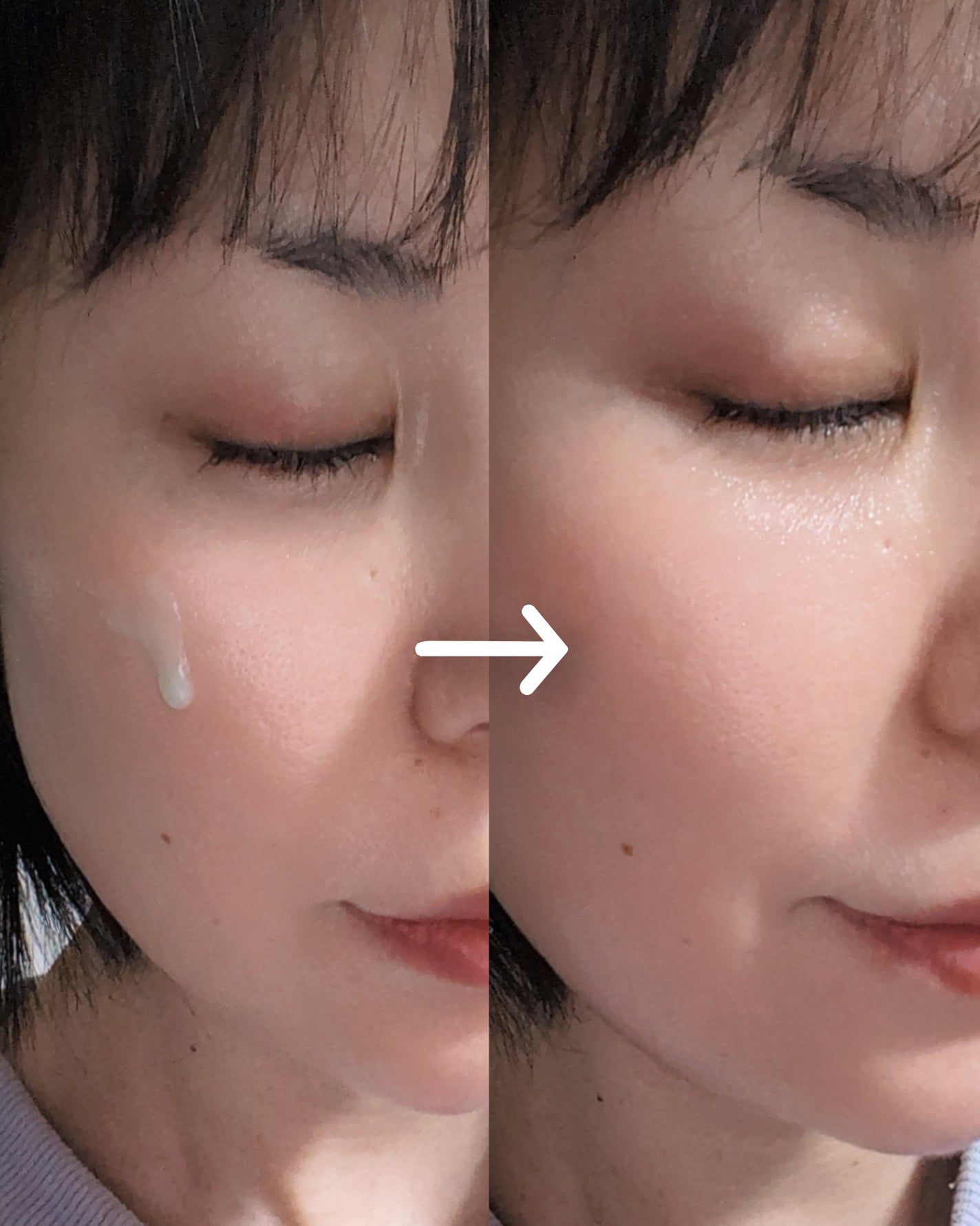 ReDRNエクソソームアンプル/Dr.nineteen/美容液を使ったクチコミ(3枚目)