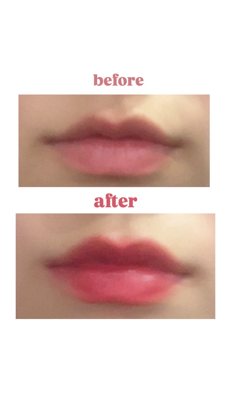 &. Wチャーム ぷっくりティント/DAISO/リップティントを使ったクチコミ（2枚目）