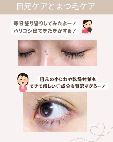 スカルプDまつ毛美容液 クイーン/アンファー(スカルプD)/まつげ美容液を使ったクチコミ(4枚目)