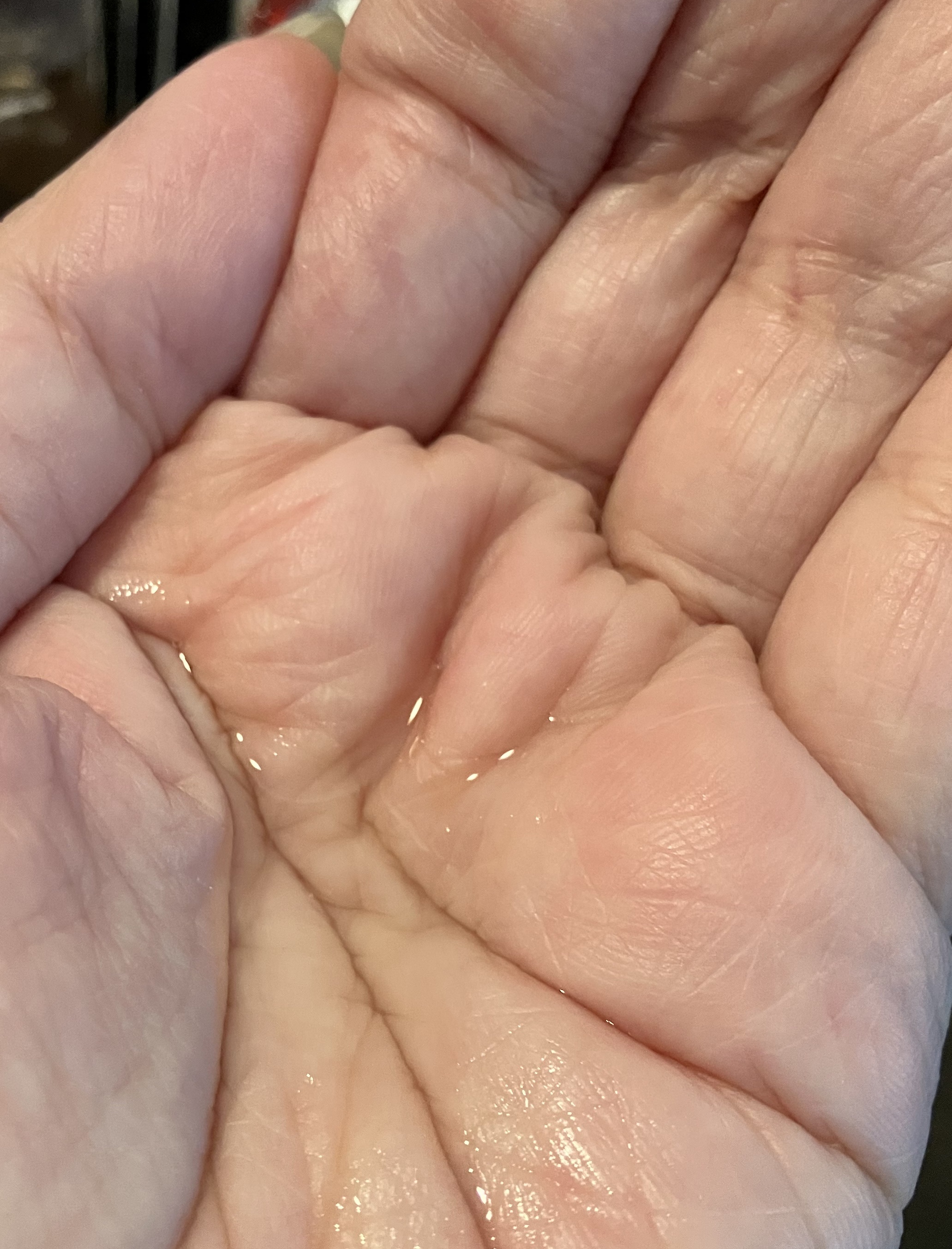 薬用クリアケア化粧水/無印良品/化粧水を使ったクチコミ（3枚目）