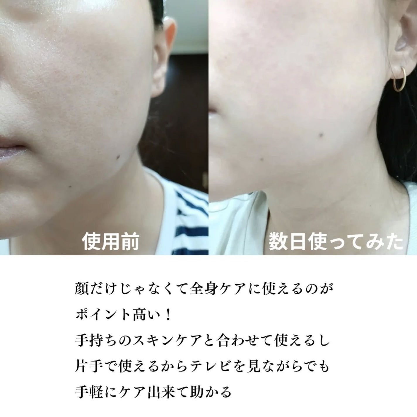 リフト美顔器/ANLAN/美顔器・マッサージを使ったクチコミ(5枚目)