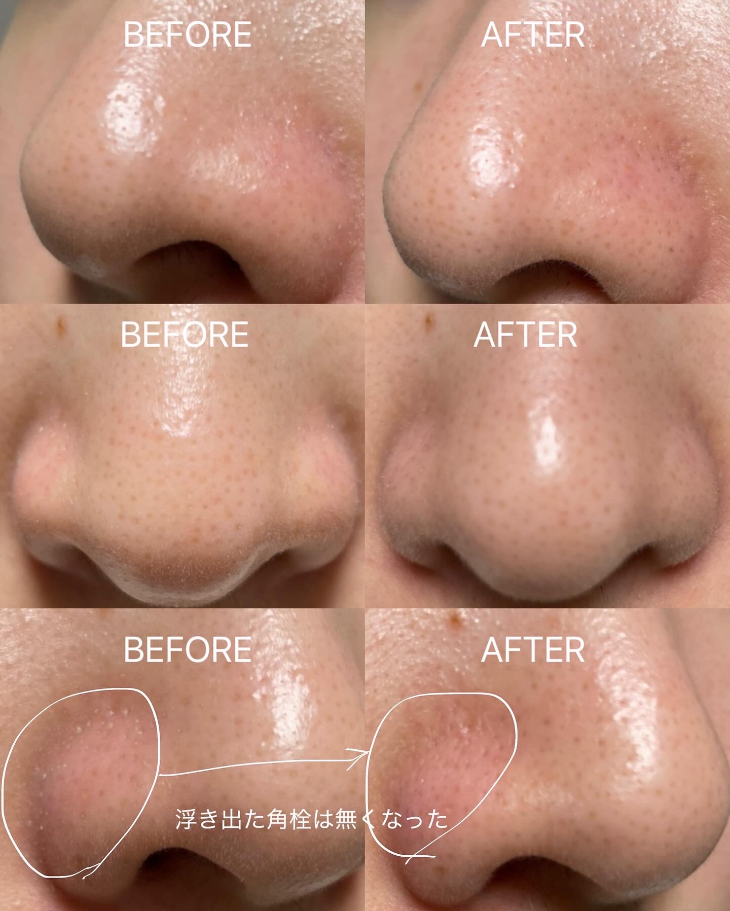 AQ 毛穴美容液オイル/DECORTÉ/フェイスオイルを使ったクチコミ（3枚目）