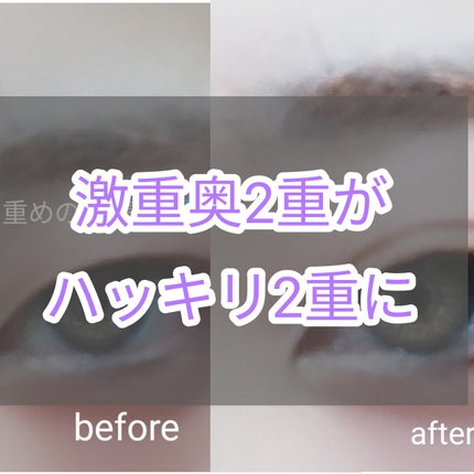 のびーるアイテープ(絆創膏タイプ、レギュラー)/DAISO/二重まぶた用アイテムを使ったクチコミ(1枚目)