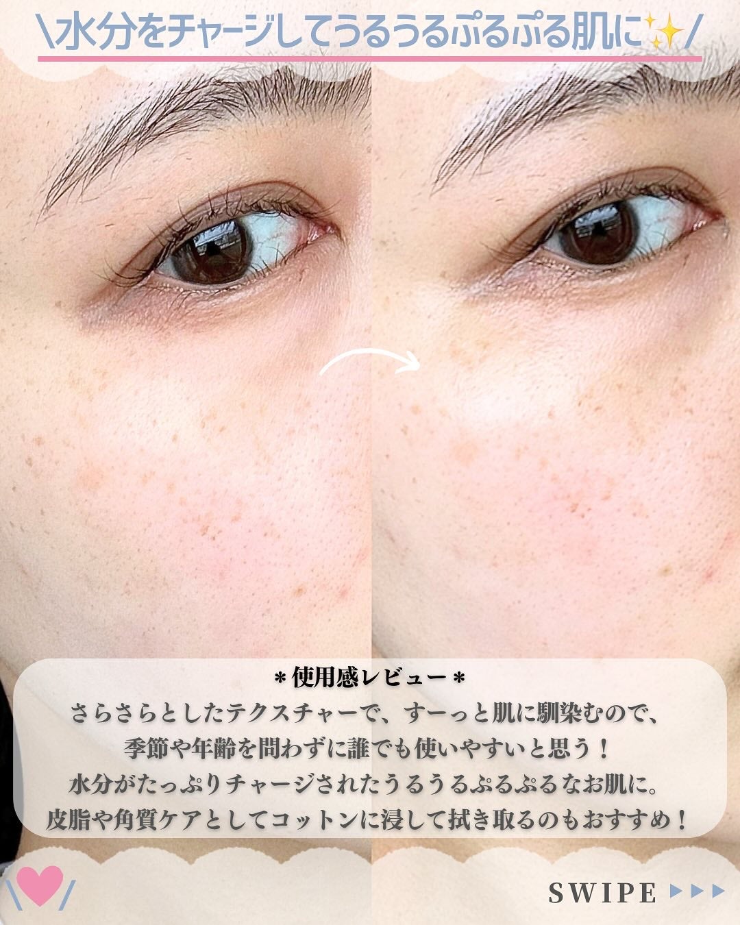 大豆トナー/mixsoon/化粧水を使ったクチコミ(5枚目)