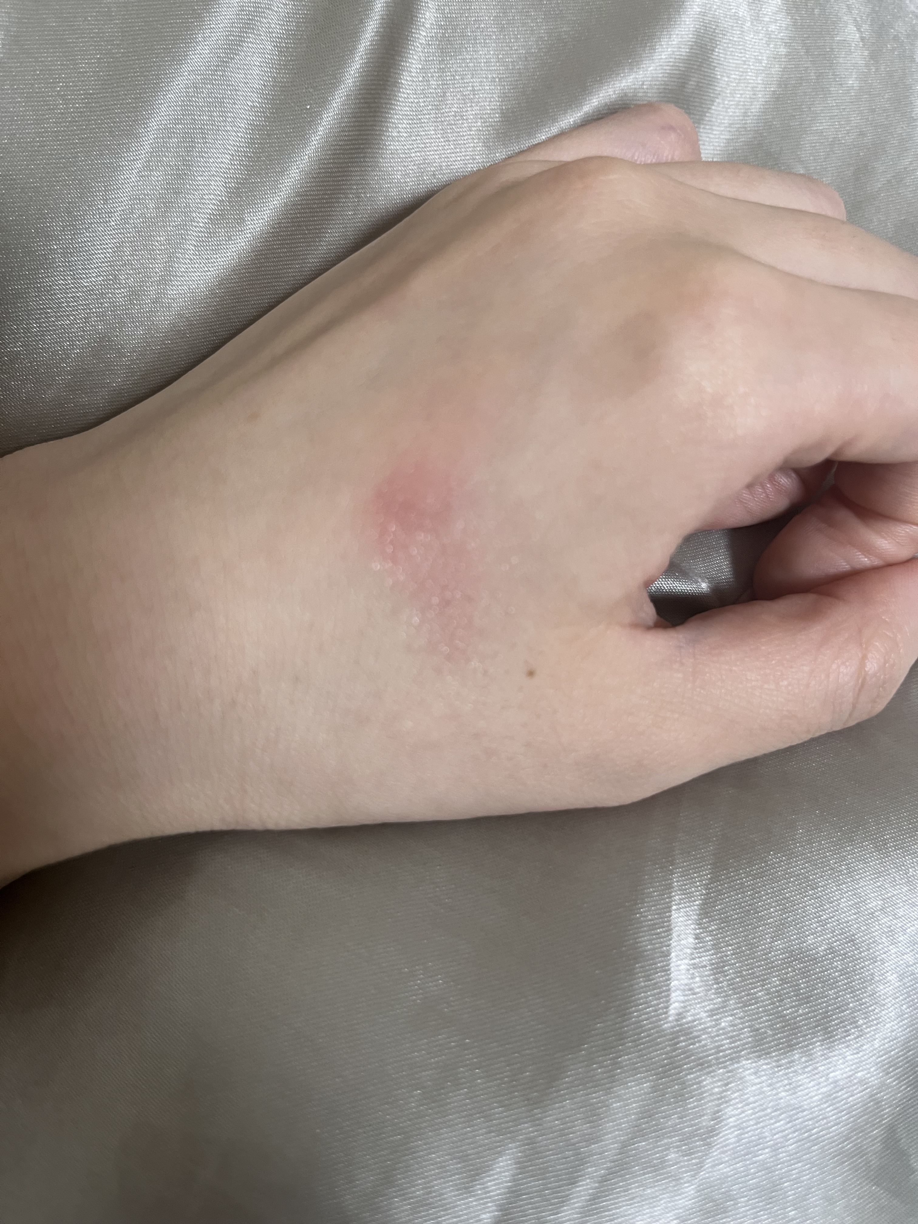 デューティント/AMUSE/リップティントを使ったクチコミ（2枚目）