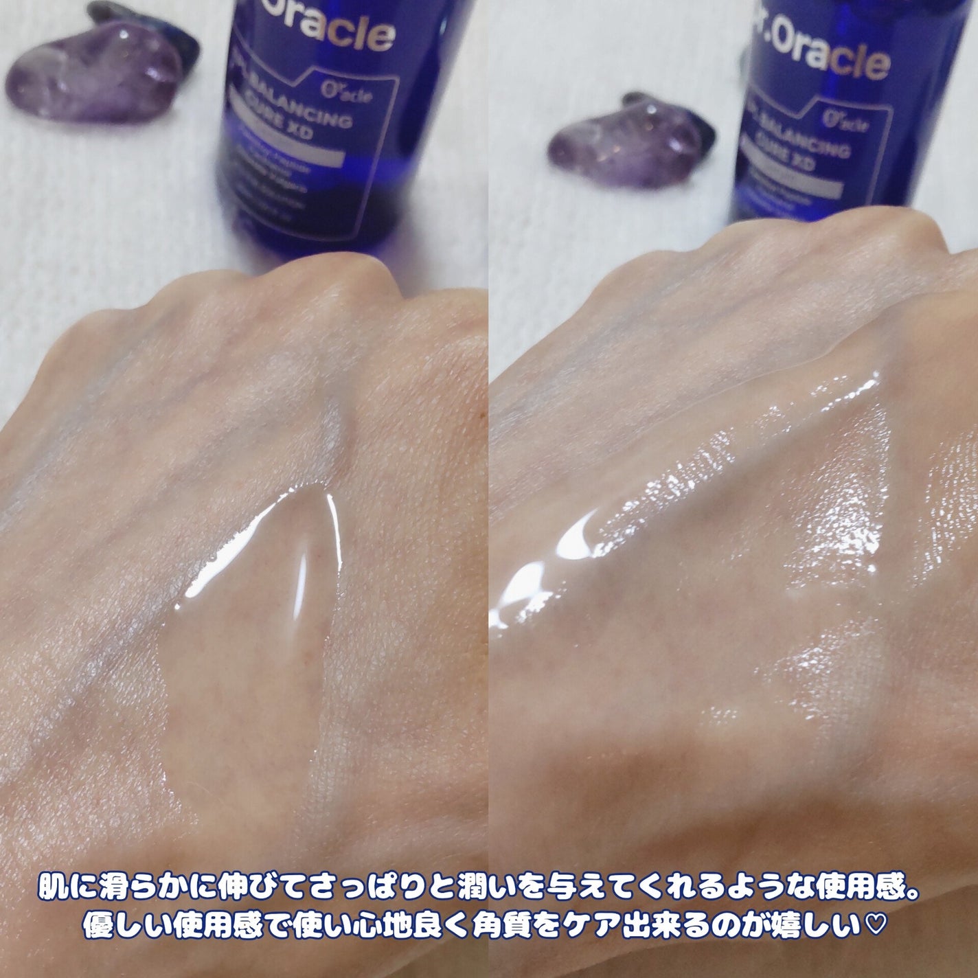 EPL キュアクリームXD/Dr.Oracle/フェイスクリームを使ったクチコミ(4枚目)