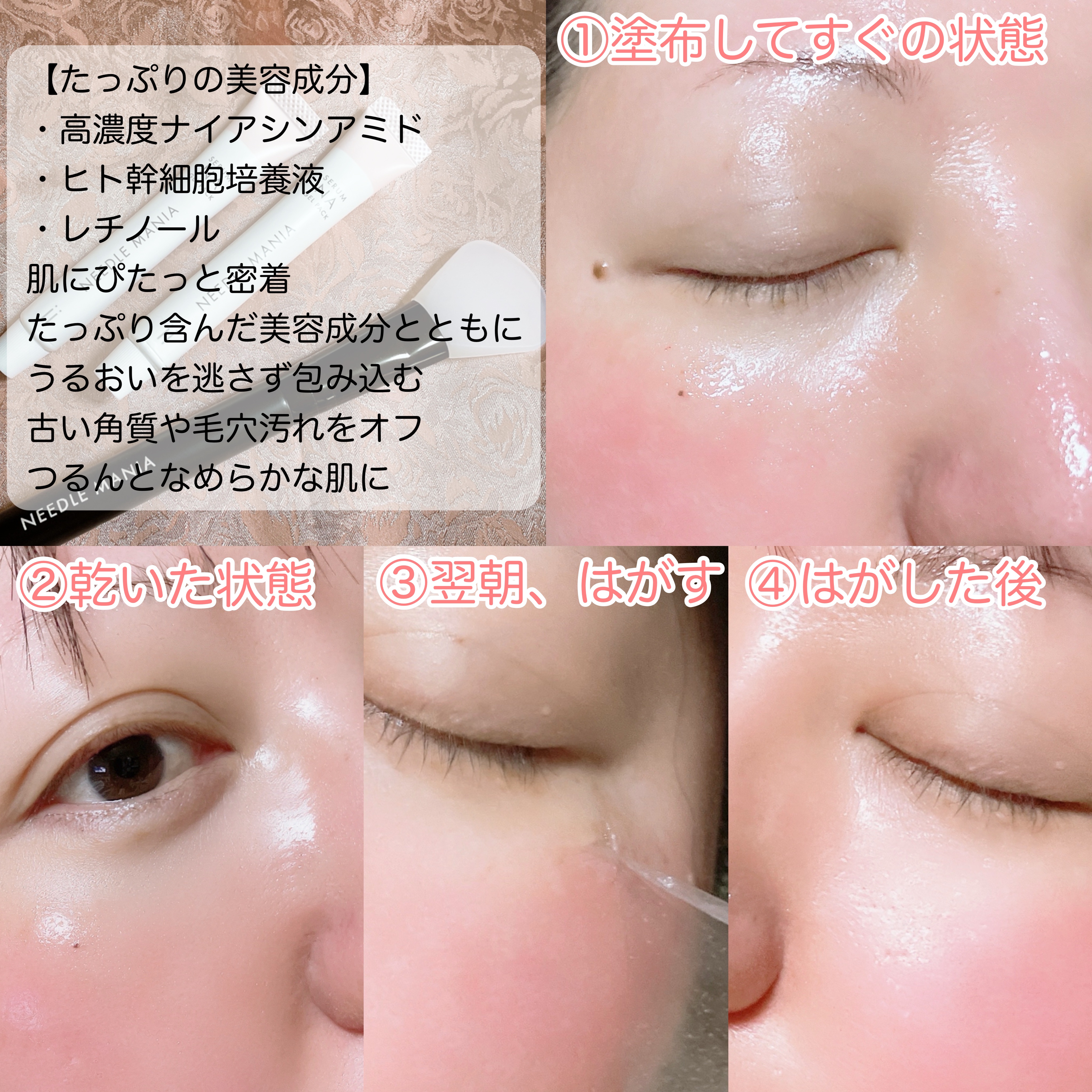 ナイアシンアミドジェルパック/NEEDLE MANIA/シートマスク・パックを使ったクチコミ（3枚目）