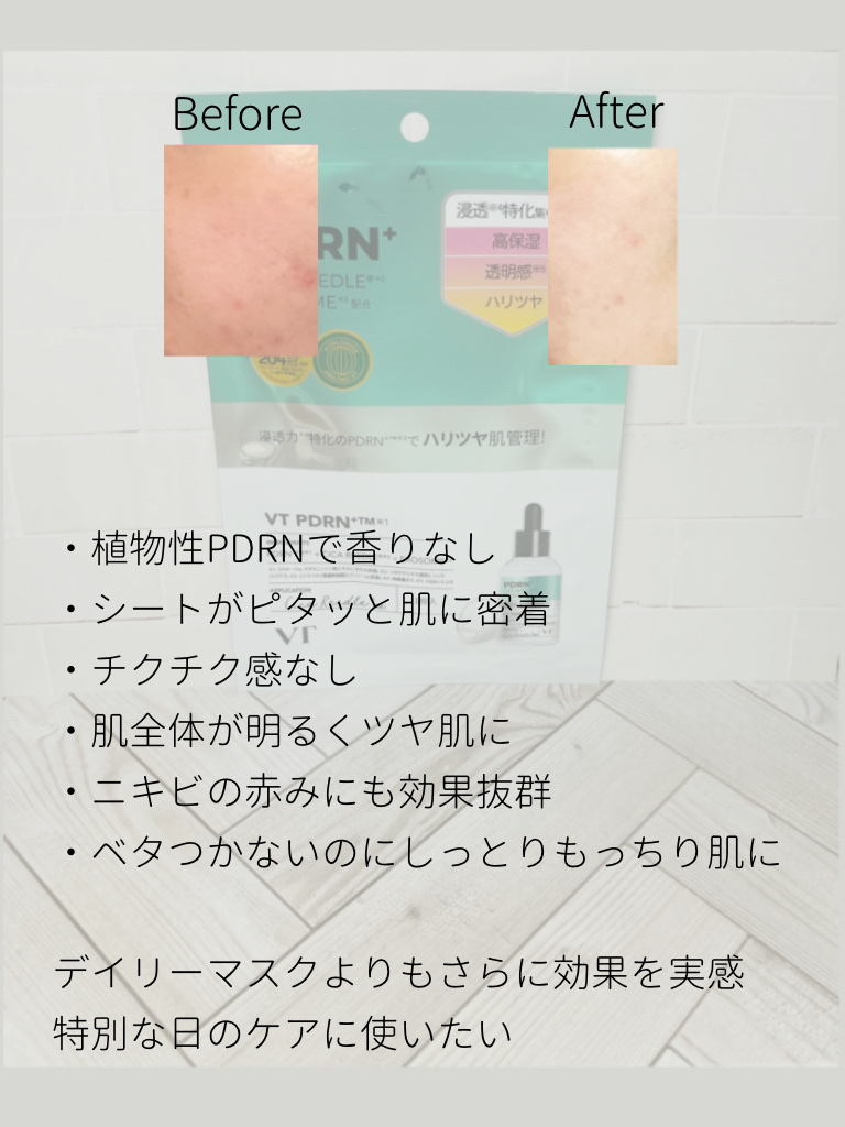 リードルS PDRN+ マスク/VT/シートマスク・パックを使ったクチコミ（3枚目）