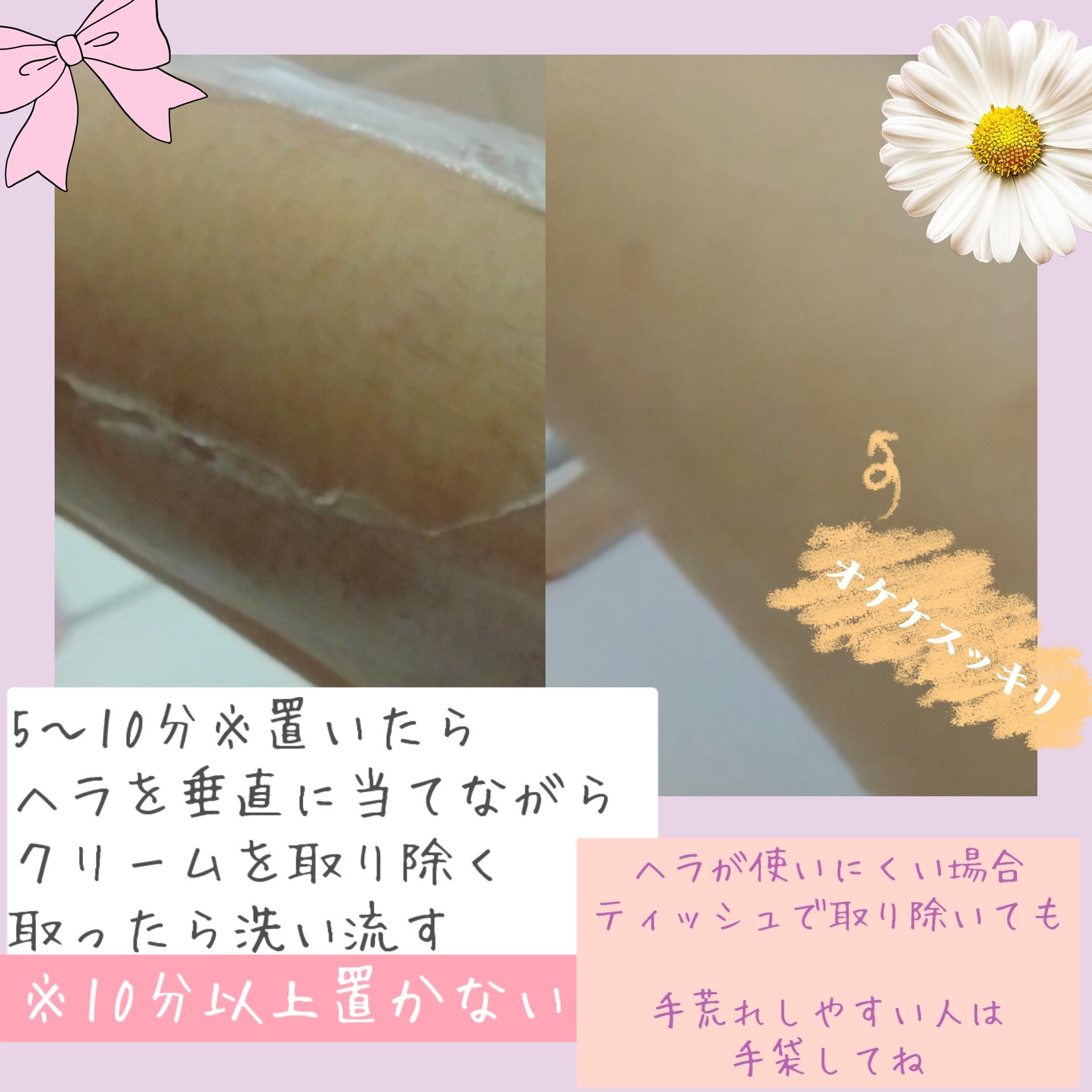 シック ハイドロシルク 除毛クリーム　/ハイドロシルク/除毛クリームを使ったクチコミ（3枚目）