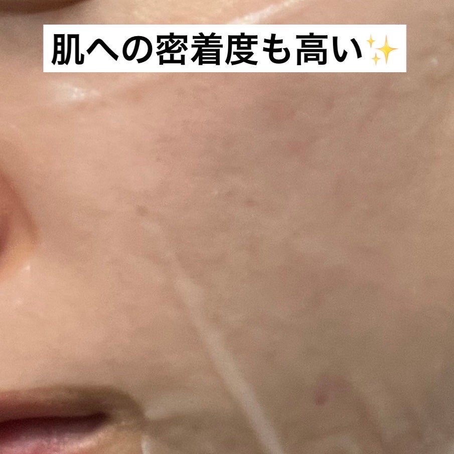 トン・スポットグロウマスク/redence/シートマスク・パックを使ったクチコミ(4枚目)