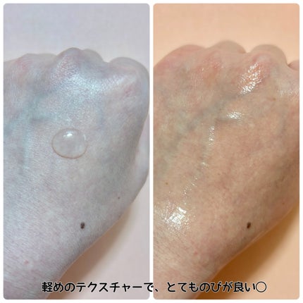 REJURAN ãã¥ã¢ã«ãšãã§ã¯ãã¢ã³ãã« 30ml/REJURAN COSMETICS/çŸå®¹æ¶²ã䜿ã£ãã¯ãã³ãïŒ6æç®ïŒ