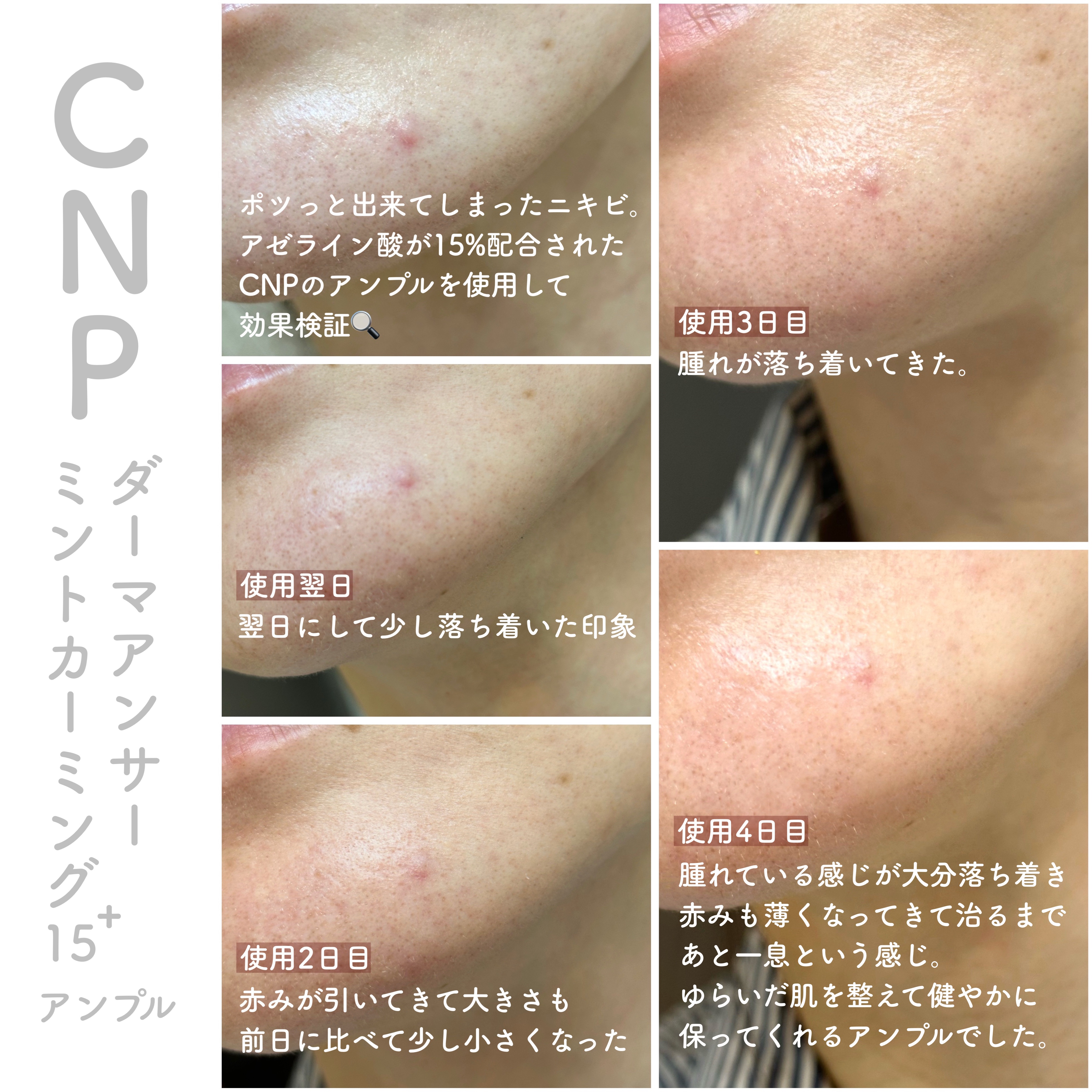 ダーマアンサーアゼライン酸ミントアンプル/CNP Laboratory/美容液を使ったクチコミ（3枚目）