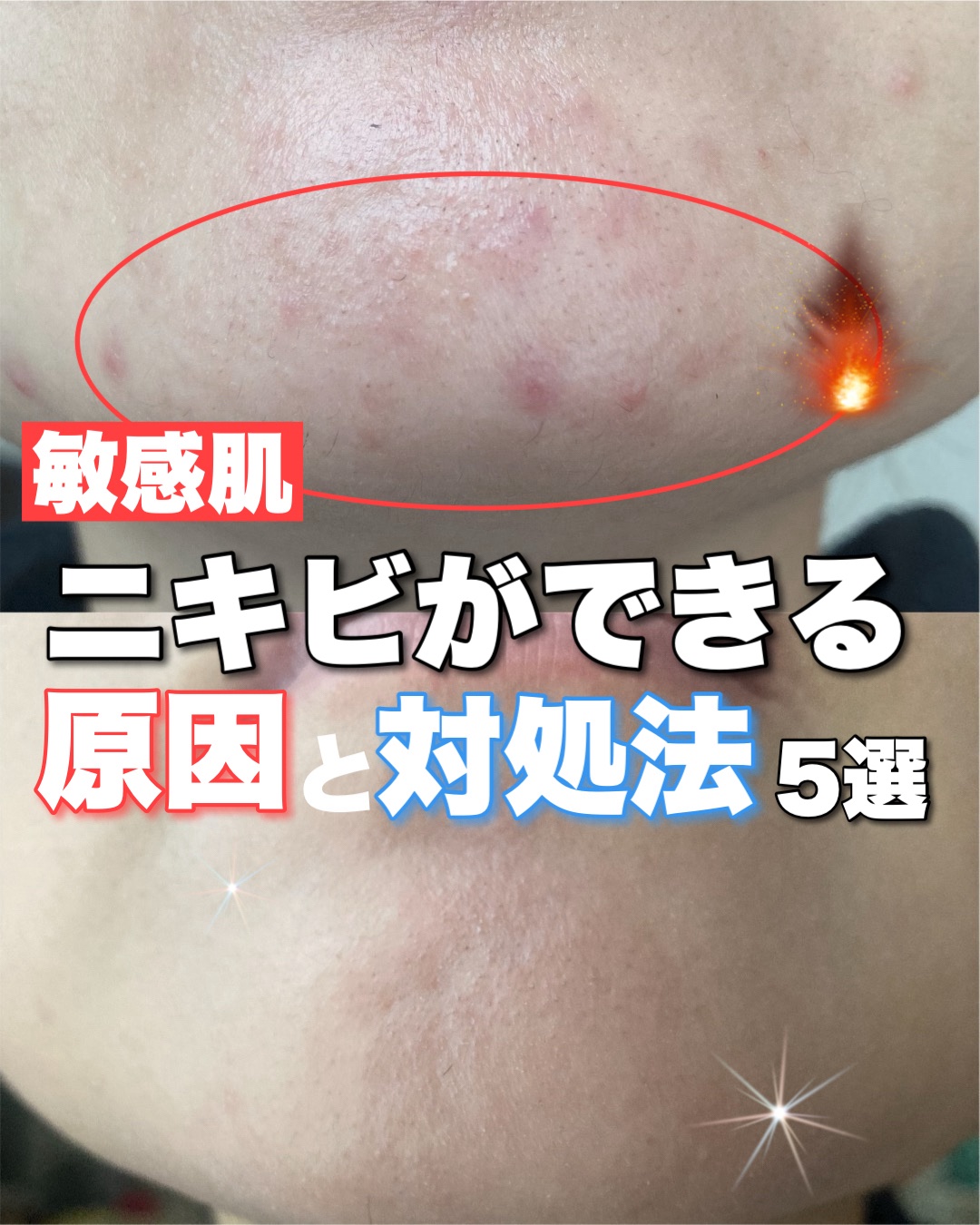 ザ・タイムR アクア/IPSA/化粧水を使ったクチコミ（1枚目）