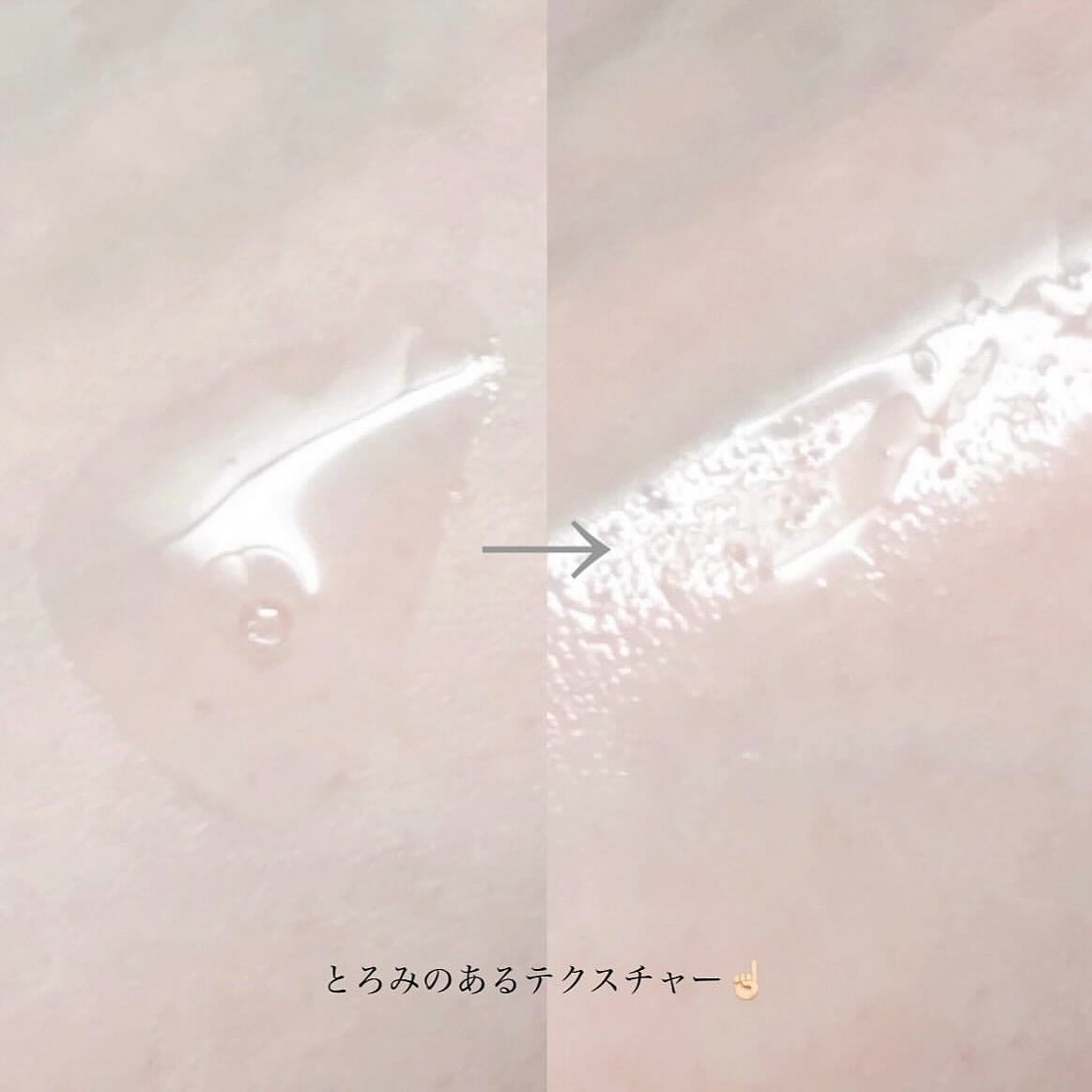 ジンクテカBセラムセット/BRING GREEN/スキンケアキットを使ったクチコミ（3枚目）