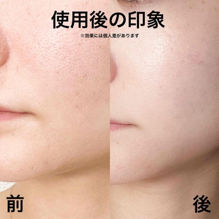 ラインリフティングハイドロゲル口角パッチ/MARSHIQUE/その他スキンケアグッズを使ったクチコミ(4枚目)