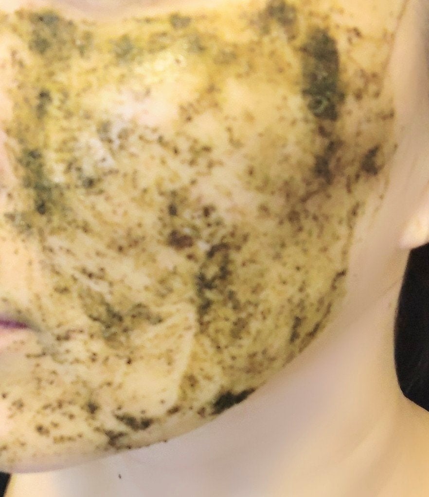 ティーツリーハーブピーリングパック/WellDerma/洗い流すパック・マスクを使ったクチコミ(6枚目)