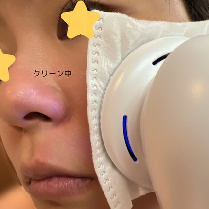温冷美顔器PRO/ANLAN/美顔器・マッサージを使ったクチコミ(6枚目)