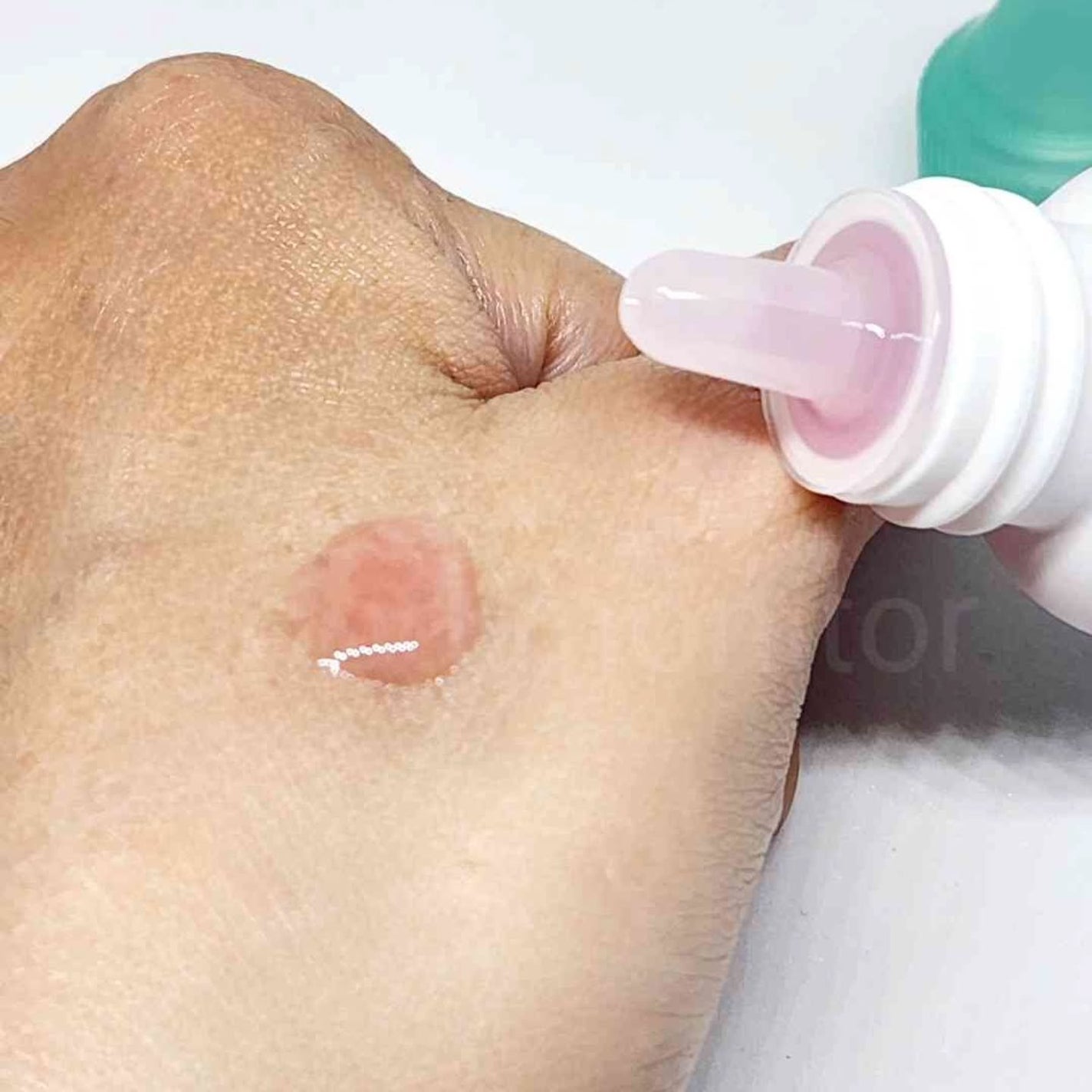 ナイアシンアミドTXA ダークスポットコレクティングセラム/Dr.Belmeur/美容液を使ったクチコミ(2枚目)