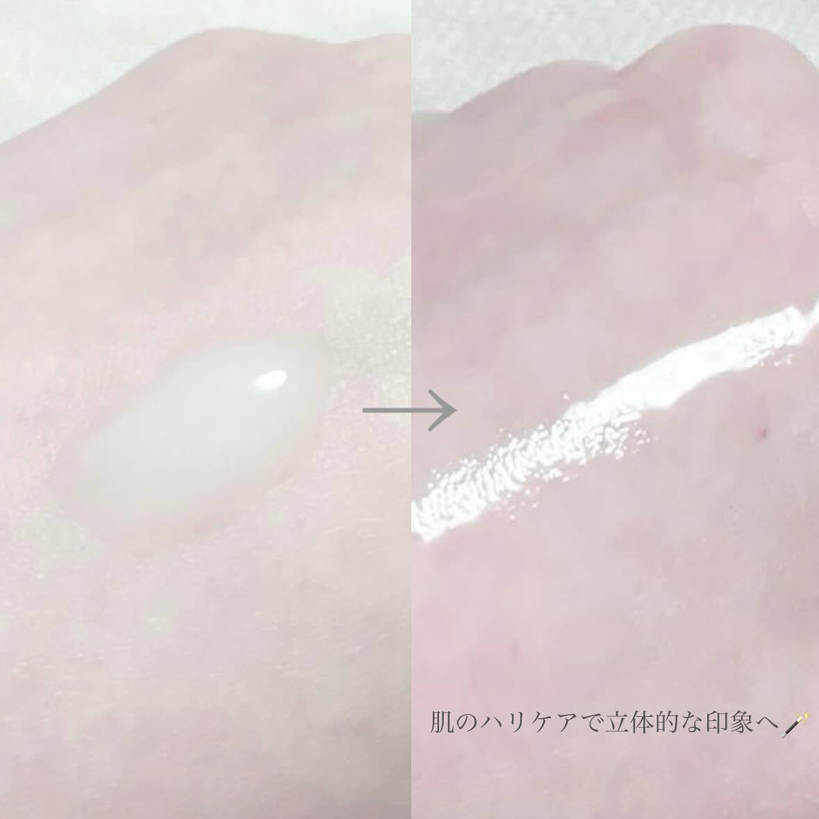 無膜ステムショット/CELLINSHOT/美容液を使ったクチコミ（3枚目）