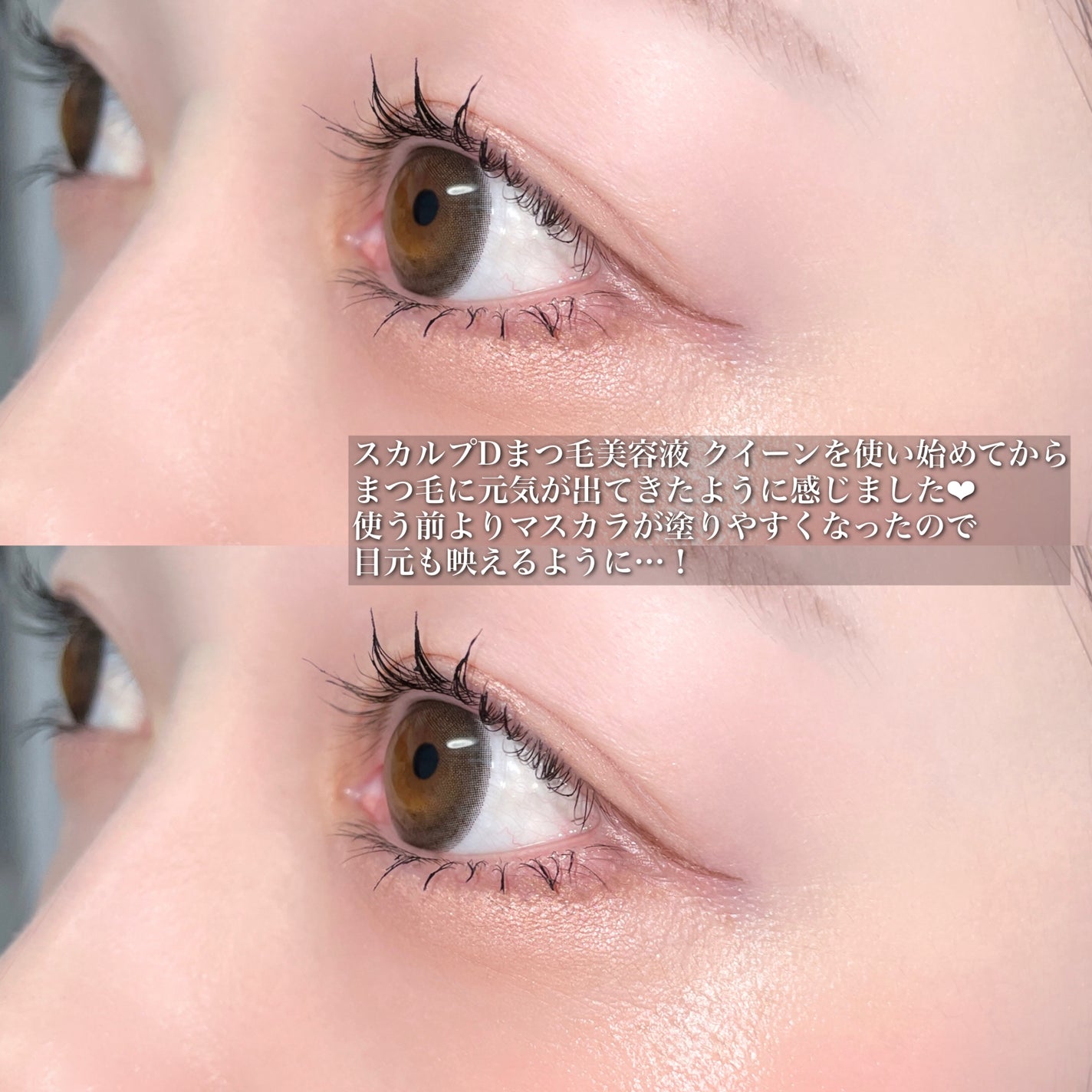 スカルプDまつ毛美容液 クイーン/アンファー(スカルプD)/まつげ美容液を使ったクチコミ(6枚目)