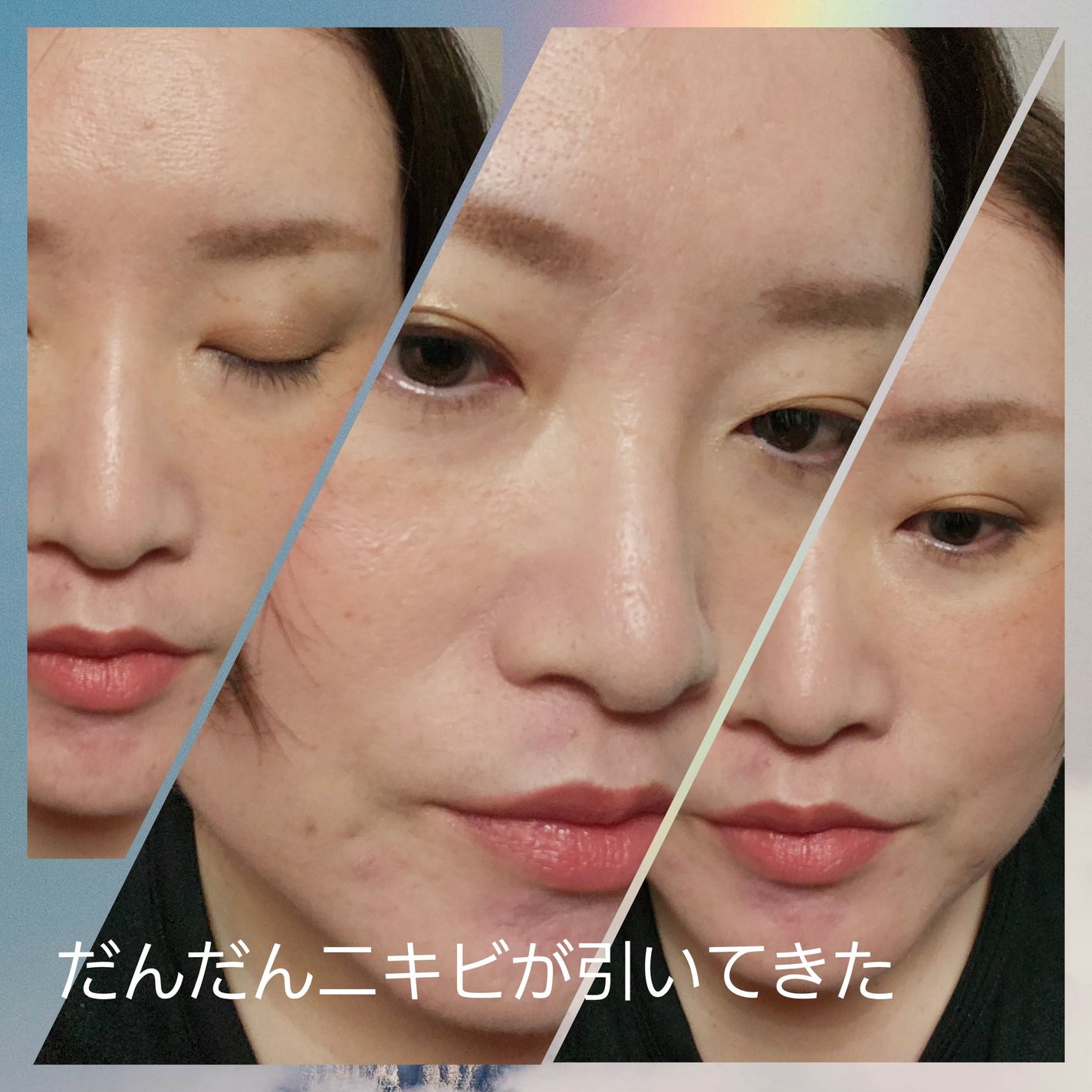ライトリフレクティングセッティングパウダー プレスト N/NARS/プレストパウダーを使ったクチコミ(3枚目)