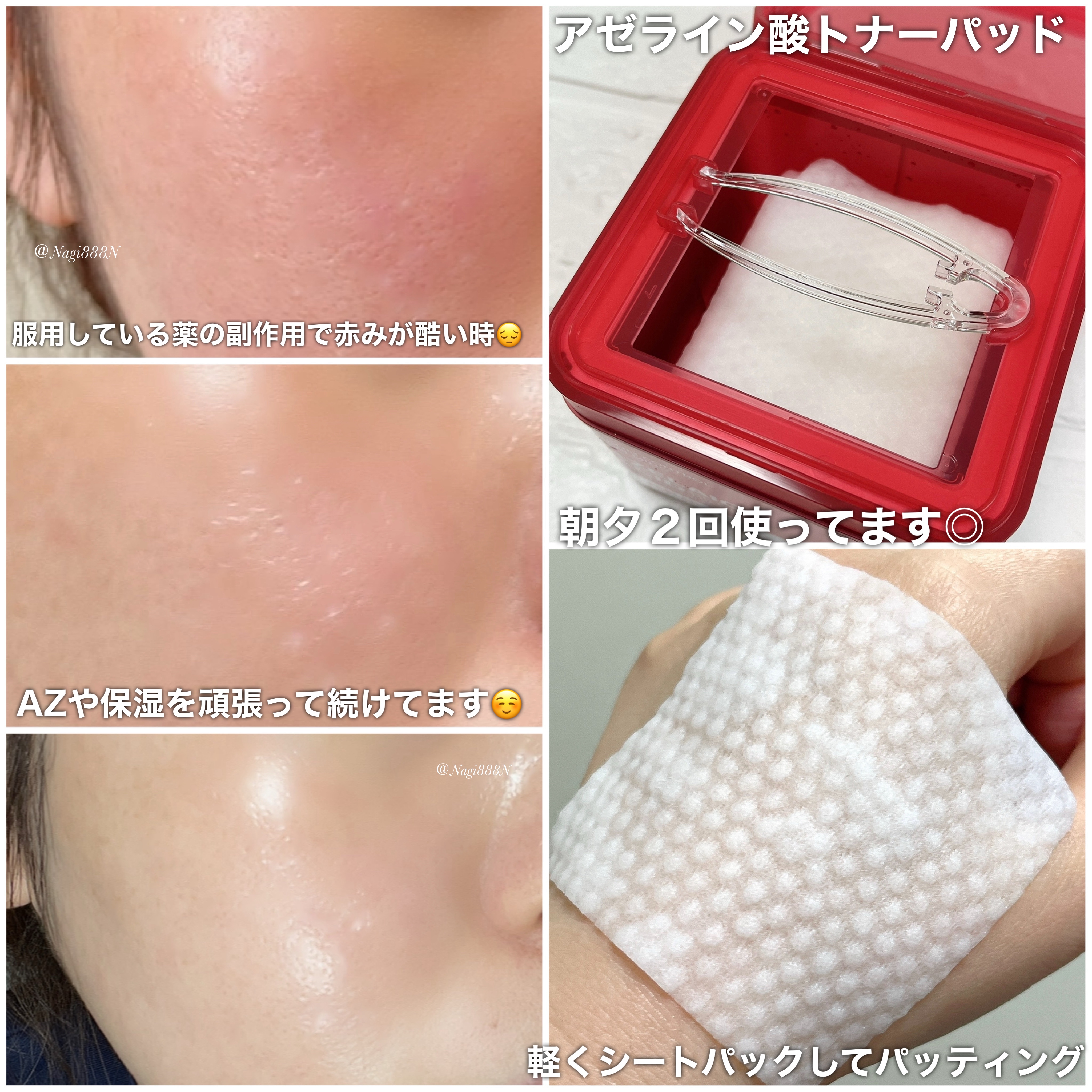 A1カーミング アンプル/VT/美容液を使ったクチコミ（2枚目）