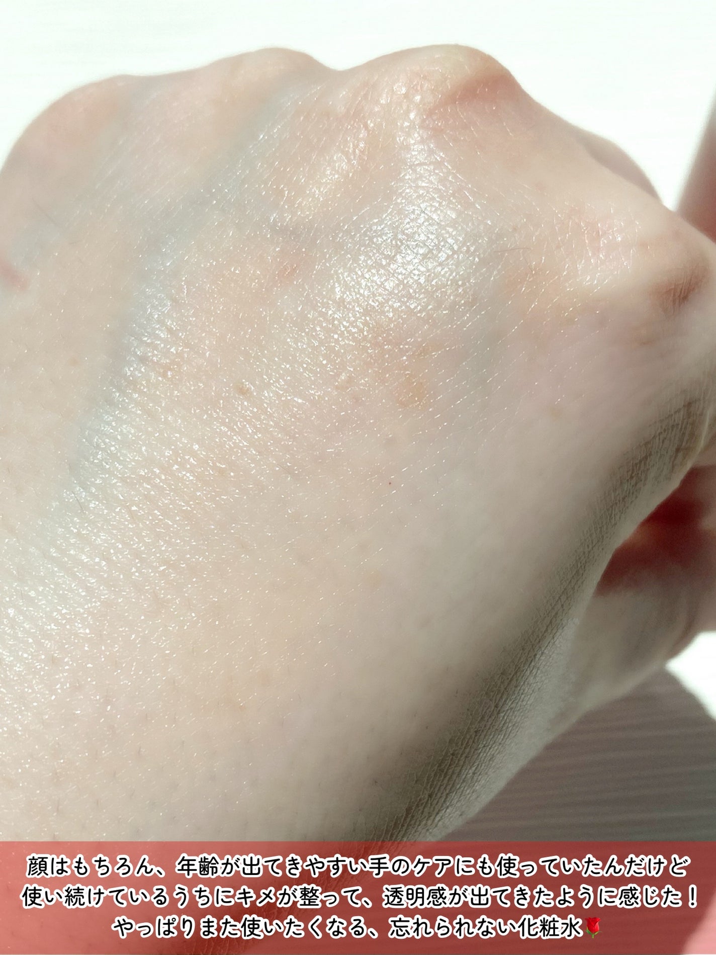 アンチリンクルファーストエッセンスオリジン/MIGUHARA/化粧水を使ったクチコミ(4枚目)