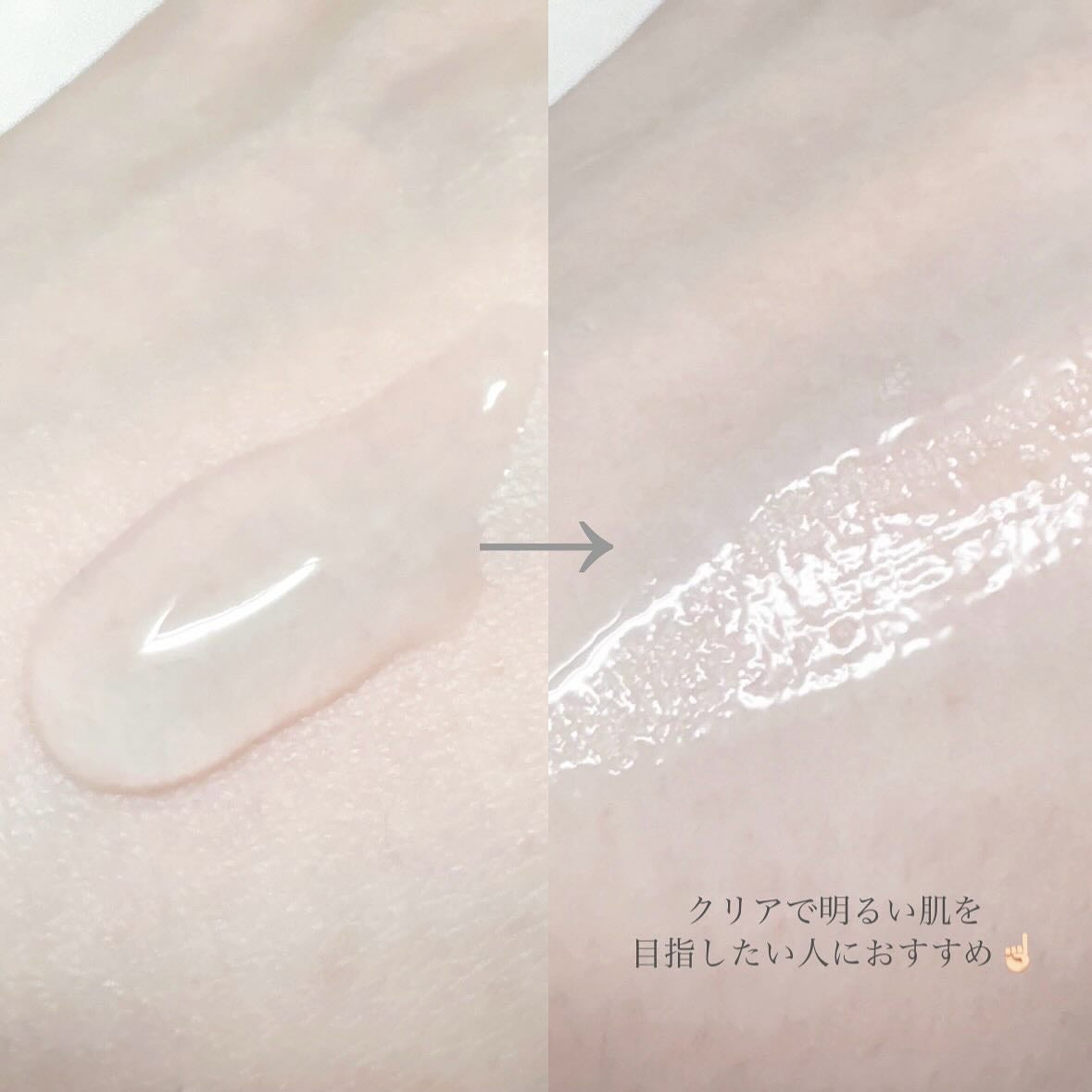 NAAP アンプル/NAAP/美容液を使ったクチコミ(5枚目)